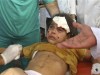 Death looms over Gaza on 27th day of Israeli assault